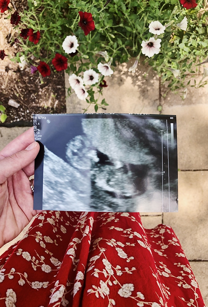 outdoor ultrasound photo next to red dress near flowers for pregnancy announcement